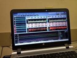 A screen displaying cardiovascular medical information. 