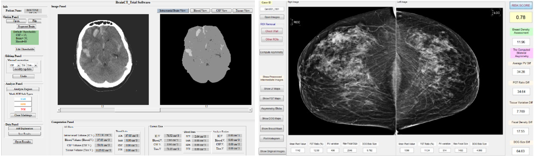 Two Examples of Graphic User Interface of CAD Schemes of Medical Images