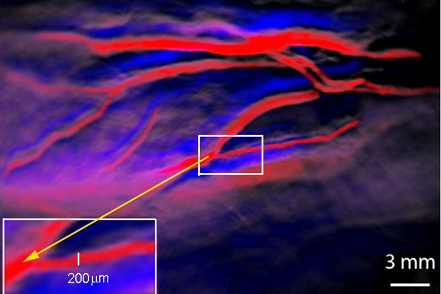 Researchers at OU Health Stephenson Cancer Center are studying a promising new imaging technique that could improve pancreatic cancer surgery. Pictured, the technique can distinguish arteries (red) and veins (blue) at the level of 200 microns, the width of a human hair. The same enhanced detection would be possible for cancer cells.