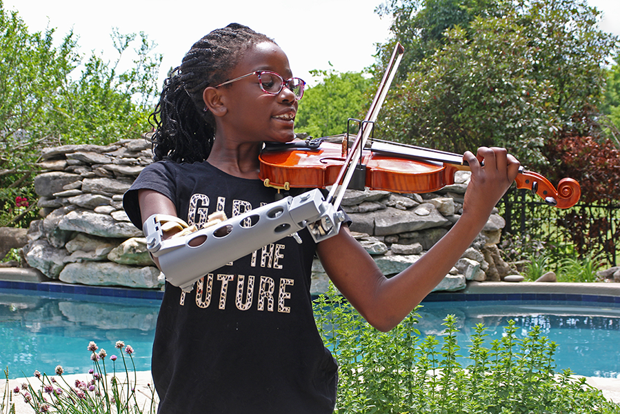 Eve, using her new prosthetic, holds up a violin to play