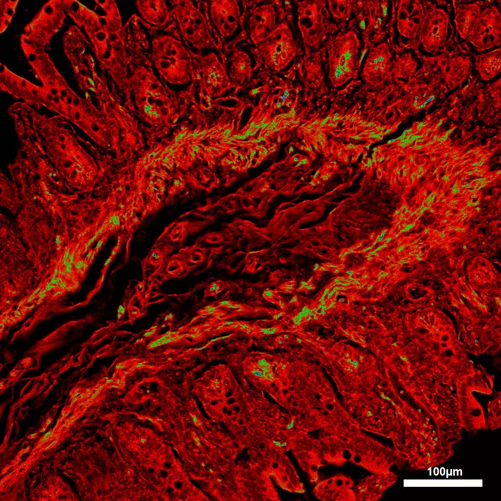 Confocal fluorescence micrograph of a human kidney histological section originally stained with hematoxylin and eosin (H&E). A collecting duct of the kidney was imaged using autofluorescence in a Leica TCS SP8 Confocal Microscope – 10X objective, a 561nm excitation laser and “6_shades” LUT (ImageJ – Fiji). This micrograph shows the histological structure of the kidney where glomerular filtrate and tubular fluids are reabsorbed by structures, such as the Loop of Henle and the proximal and distal tubules. (Sergio A. Pineda-Castillo, Ph.D. student in Biomedical Engineering).
