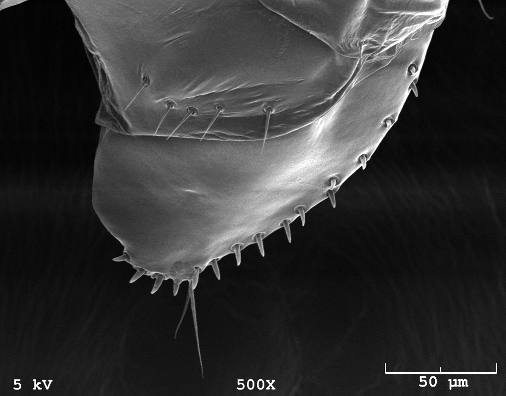 Female Drosophila genitalia. Scanning electron microscope image taken by Preston Larson in OU's Samuel Robert Noble Microscopy lab.