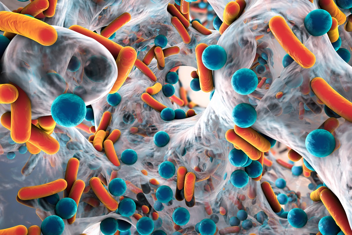 Rendering of biofilm of antibiotic resistant bacteria