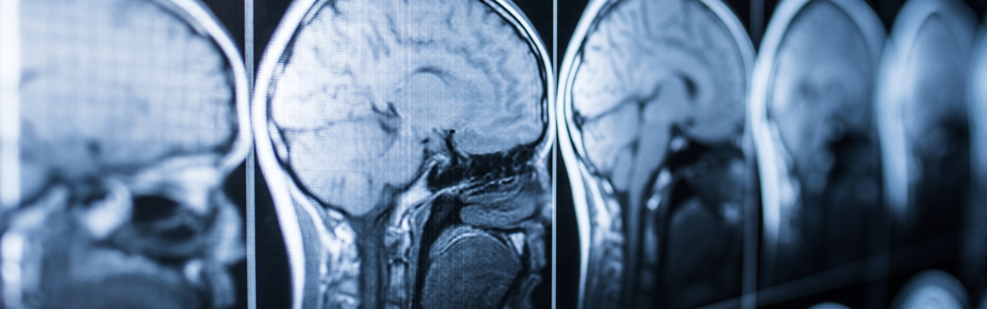 MRI scans of human head